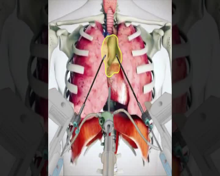 Tumore di 10 centimetri sopra il cuore, 51enne salvato con tecnica robotica